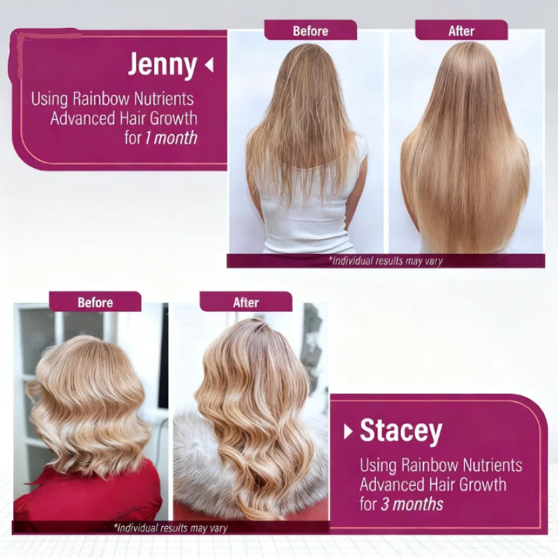 Vitaminas Uro para Mujeres con Biotina 10000 mcg y Colágeno (120 Cápsulas) – Cuidado para Cabello, Piel y Uñas