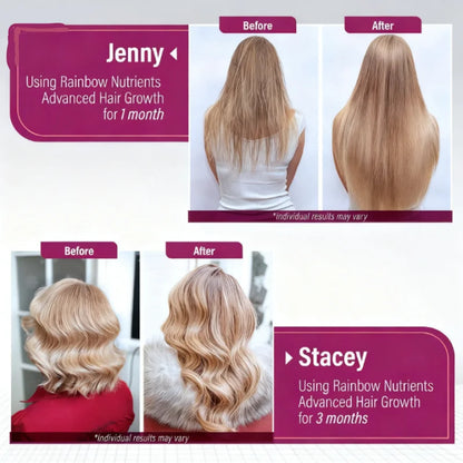 Vitaminas Uro para Mujeres con Biotina 10000 mcg y Colágeno (120 Cápsulas) – Cuidado para Cabello, Piel y Uñas